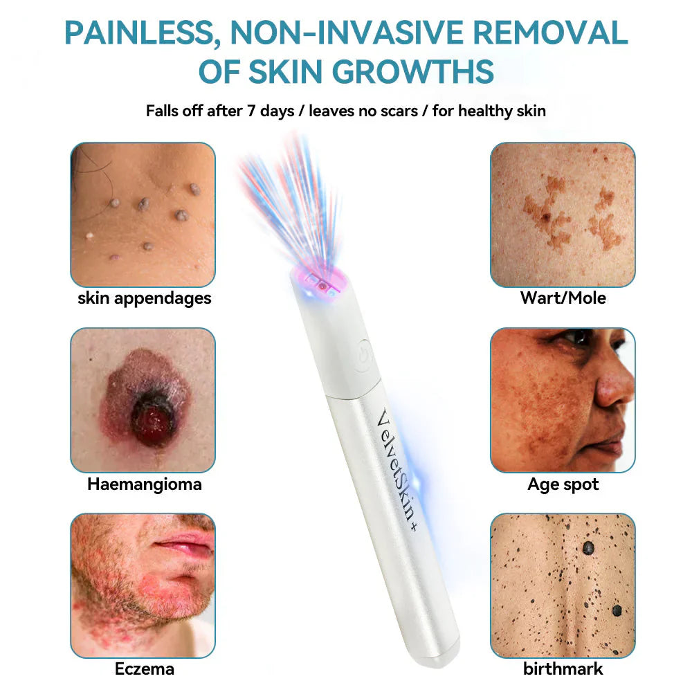 🇨🇦 Bikenda® VelvetSkin+ All-in-One Laser Eraser Pen(Powered by CO₂ laser technology – effectively removes moles, warts, skin tags, pigmentation spots, and other skin imperfections)