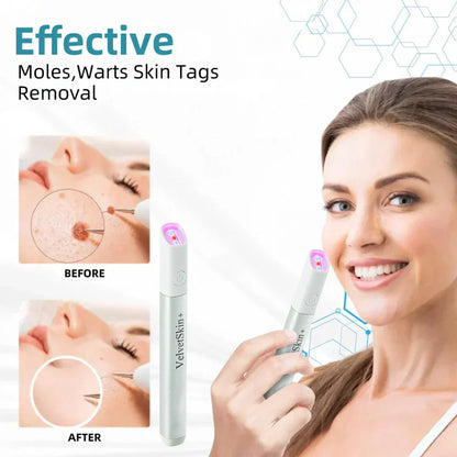 🇨🇦 Bikenda® VelvetSkin+ All-in-One Laser Eraser Pen(Powered by CO₂ laser technology – effectively removes moles, warts, skin tags, pigmentation spots, and other skin imperfections)
