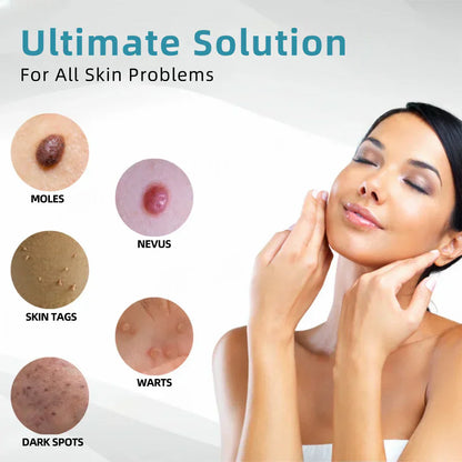 🇨🇦 Bikenda® VelvetSkin+ All-in-One Laser Eraser Pen(Powered by CO₂ laser technology – effectively removes moles, warts, skin tags, pigmentation spots, and other skin imperfections)